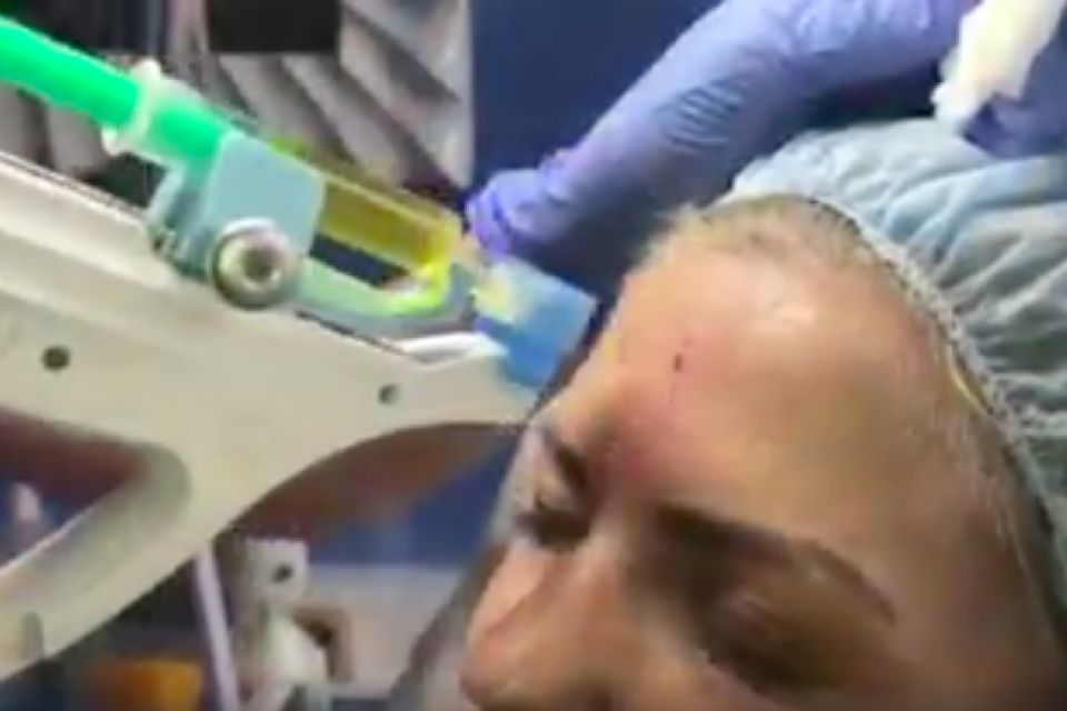 Autotransplantat Des Plasmas